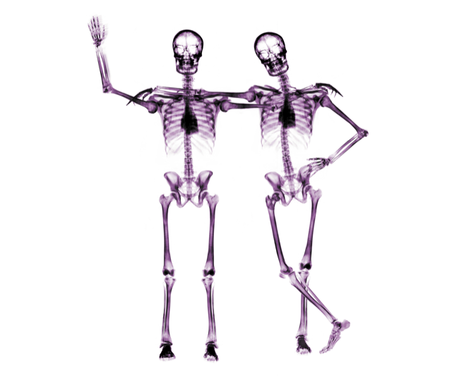 Fascia as a Soft Skeleton 